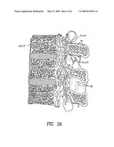 Methods of perispinal extrathecal administration of large molecules for diagnostic use in mammals diagram and image