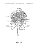 Methods of perispinal extrathecal administration of large molecules for diagnostic use in mammals diagram and image