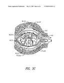 Methods of perispinal extrathecal administration of large molecules for diagnostic use in mammals diagram and image