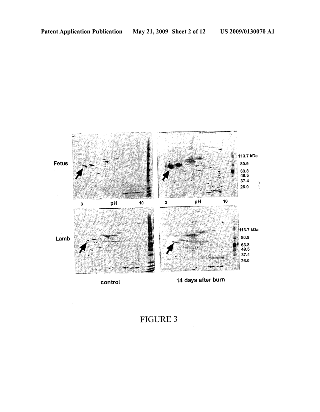 METHOD OF TREATMENT - diagram, schematic, and image 03