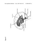 INTRAVENTRICULAR ENZYME DELIVERY FOR LYSOSOMAL STORAGE DISEASES diagram and image