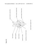 INTRAVENTRICULAR ENZYME DELIVERY FOR LYSOSOMAL STORAGE DISEASES diagram and image