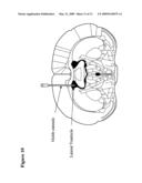 INTRAVENTRICULAR ENZYME DELIVERY FOR LYSOSOMAL STORAGE DISEASES diagram and image