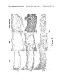 POLY (ESTER URETHANE) UREA FOAMS WITH ENHANCED MECHANICAL AND BIOLOGICAL PROPERTIES diagram and image