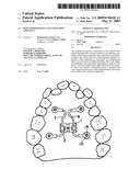 Bone supported palatal expansion appliance diagram and image