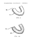 Methods and kits for making flexible dental guards diagram and image