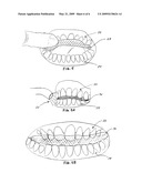 Methods and kits for making flexible dental guards diagram and image