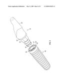 TWO-PIECE DENTAL ABUTMENT SYSTEM diagram and image