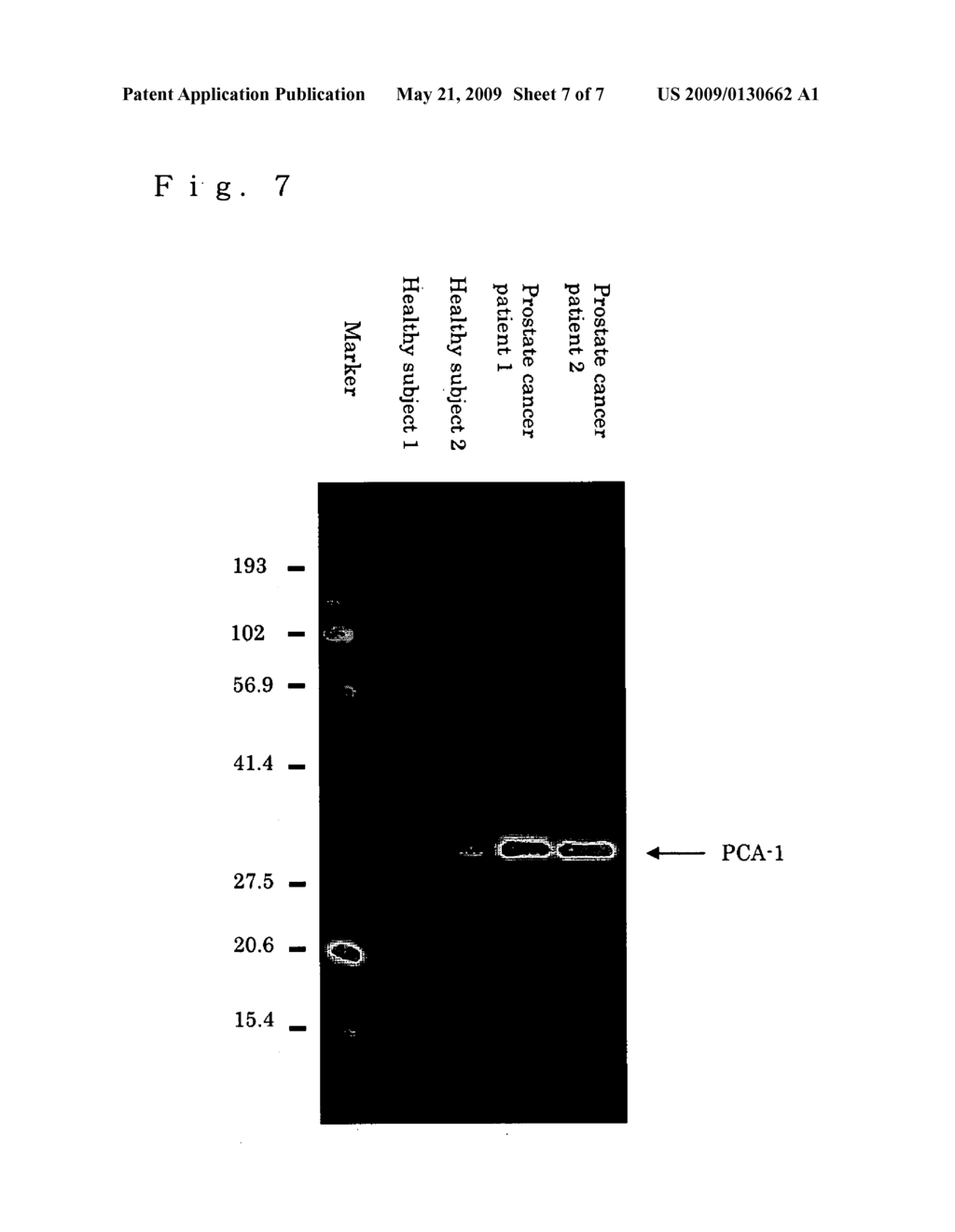 Method for Diagnosis of Prostate Cancer - diagram, schematic, and image 08