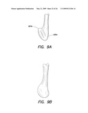 BASEBALL BAT diagram and image