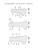 BASEBALL BAT diagram and image