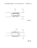 Lumen-traveling biological interface device and method of use diagram and image