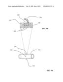 Lumen-traveling biological interface device and method of use diagram and image