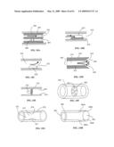 Lumen-traveling biological interface device and method of use diagram and image