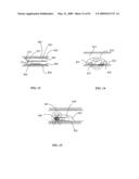 Lumen-traveling biological interface device and method of use diagram and image