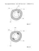 Lumen-traveling biological interface device and method of use diagram and image