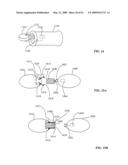 Lumen-traveling biological interface device and method of use diagram and image