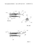 Lumen-traveling biological interface device and method of use diagram and image