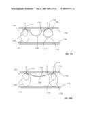 Lumen-traveling biological interface device and method of use diagram and image