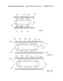 Lumen-traveling biological interface device and method of use diagram and image