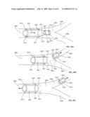 Lumen-traveling biological interface device and method of use diagram and image