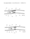 Lumen-traveling biological interface device and method of use diagram and image