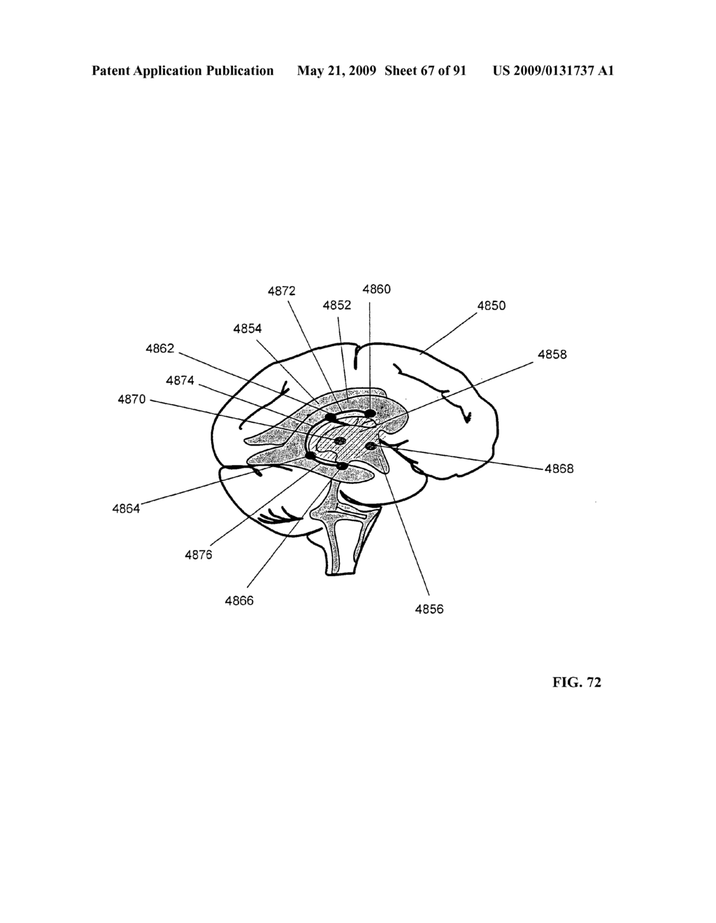 Lumen-traveling biological interface device and method of use - diagram, schematic, and image 68