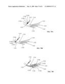 Lumen-traveling biological interface device and method of use diagram and image