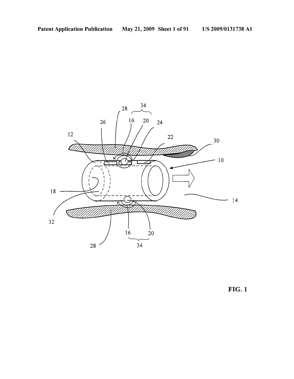 Lumen-traveling biological interface device and method of use - diagram, schematic, and image 02