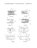 Lumen-traveling biological interface device and method of use diagram and image