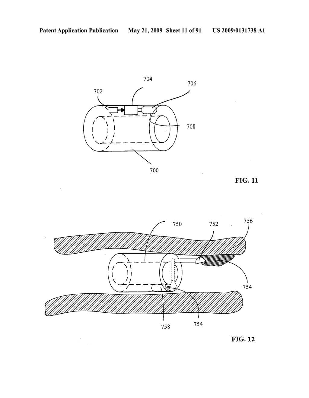 Lumen-traveling biological interface device and method of use - diagram, schematic, and image 12