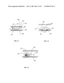 Lumen-traveling biological interface device and method of use diagram and image