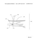 Lumen-traveling biological interface device and method of use diagram and image