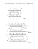 Lumen-traveling biological interface device and method of use diagram and image