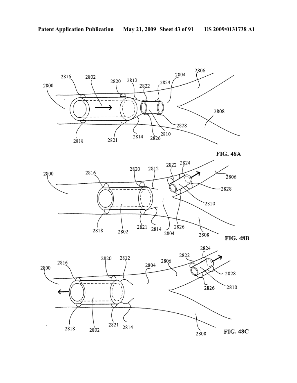 Lumen-traveling biological interface device and method of use - diagram, schematic, and image 44