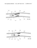 Lumen-traveling biological interface device and method of use diagram and image