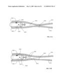 Lumen-traveling biological interface device and method of use diagram and image