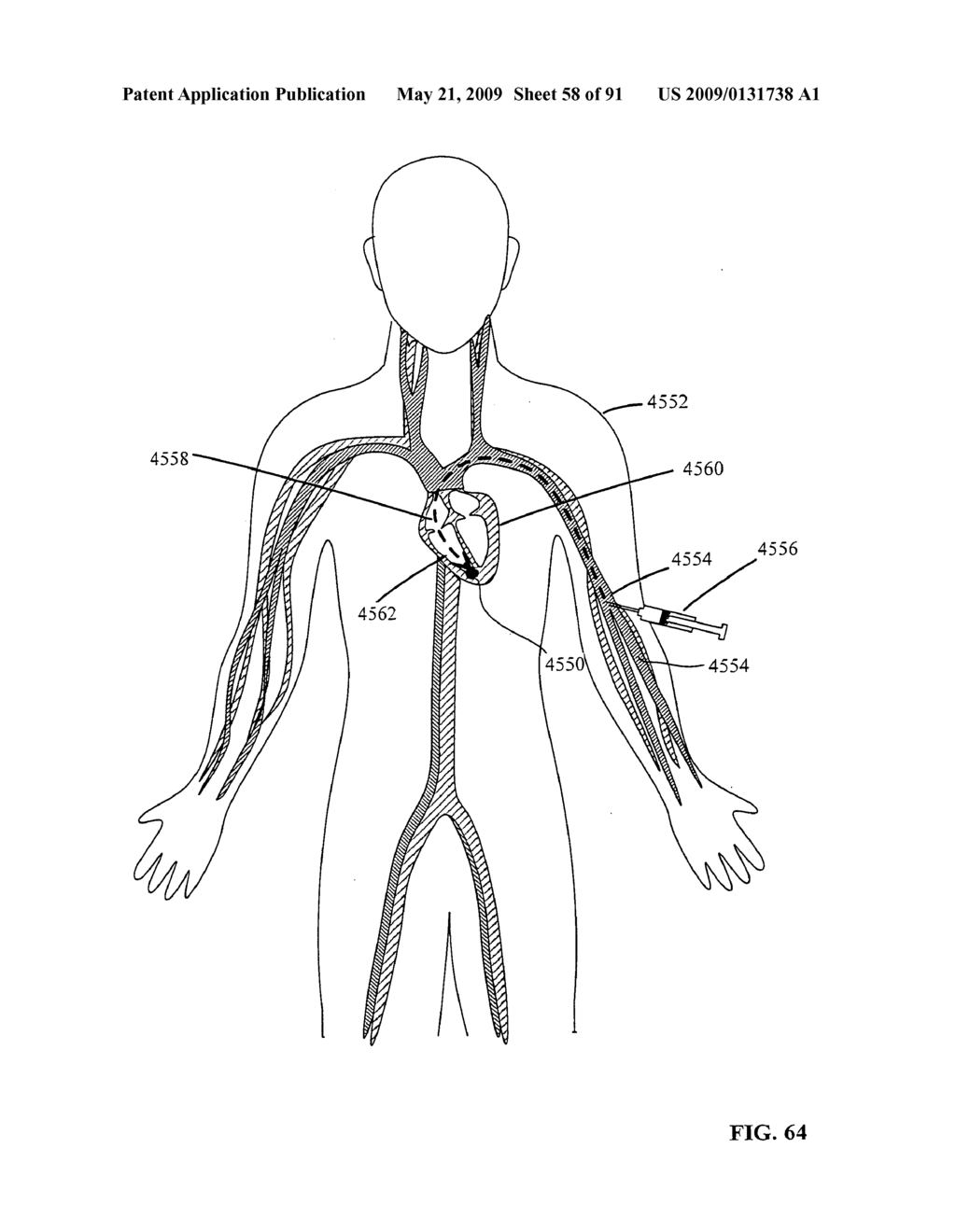 Lumen-traveling biological interface device and method of use - diagram, schematic, and image 59