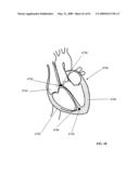 Lumen-traveling biological interface device and method of use diagram and image