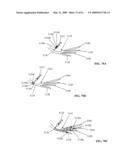 Lumen-traveling biological interface device and method of use diagram and image