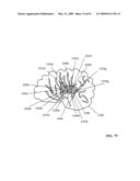 Lumen-traveling biological interface device and method of use diagram and image