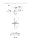 TISSUE REMOVAL SYSTEM AND METHOD USING REINFORCED LOOP diagram and image