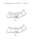 TISSUE REMOVAL SYSTEM AND METHOD USING REINFORCED LOOP diagram and image