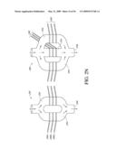 ANALYTE SENSOR diagram and image