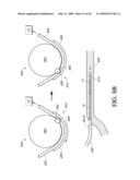 ANALYTE SENSOR diagram and image