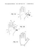 ARM POSITIONER FOR DIAGNOSTIC PROCEDURE diagram and image