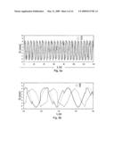 Device for Heat Treating Moving Biological Tissues and Related Method diagram and image