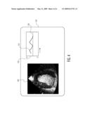 Ultrasonic Diagnostic Imaging System With Spectral and Audio Tissue Doppler diagram and image