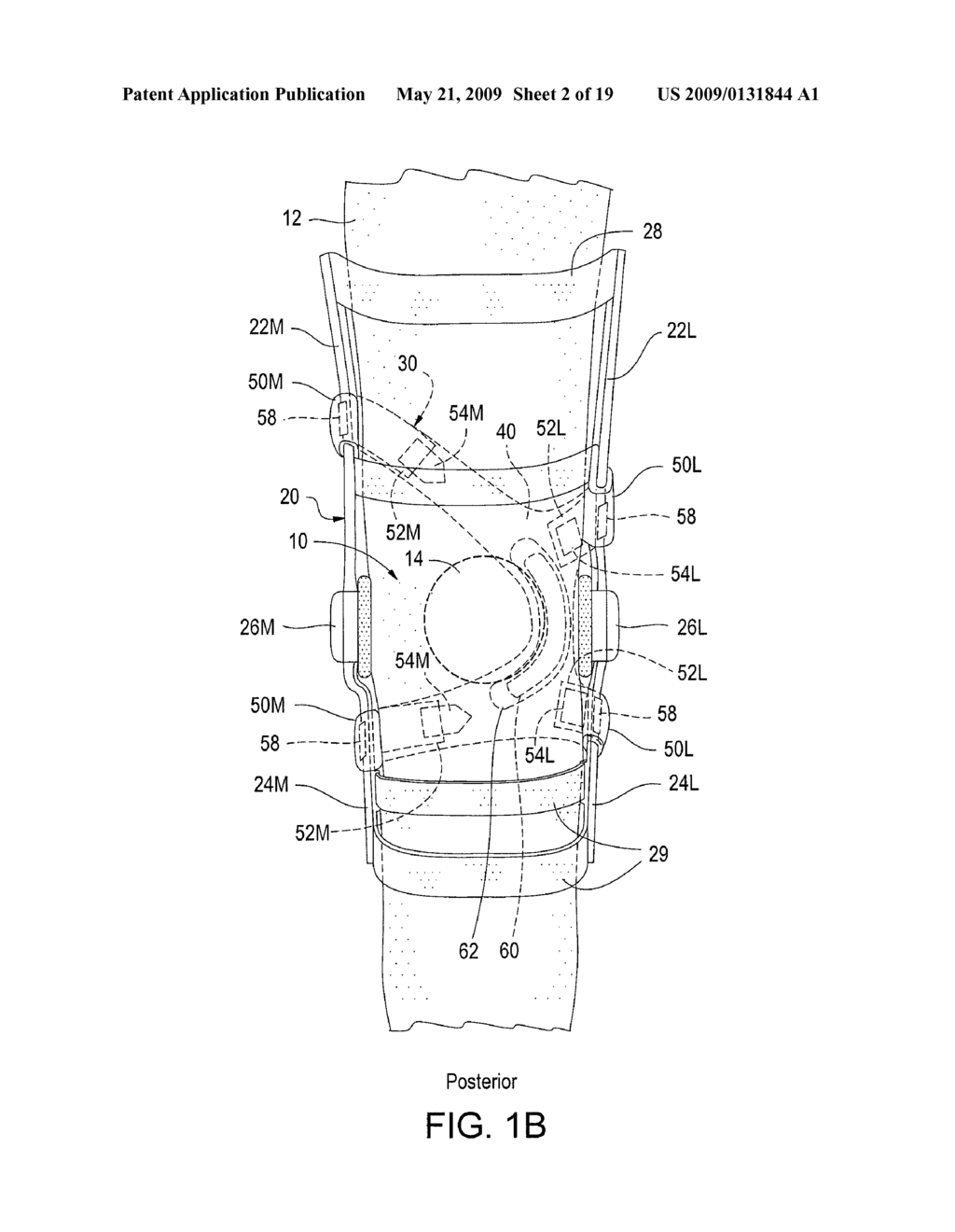 Tension Strap for Migration Prevention and Patellar Stabilization for Use With Knee Braces - diagram, schematic, and image 03