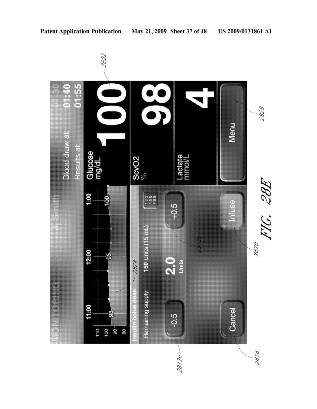 FLUID COMPONENT ANALYSIS SYSTEM AND METHOD FOR GLUCOSE MONITORING AND CONTROL - diagram, schematic, and image 38